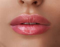 Aumento de Labios